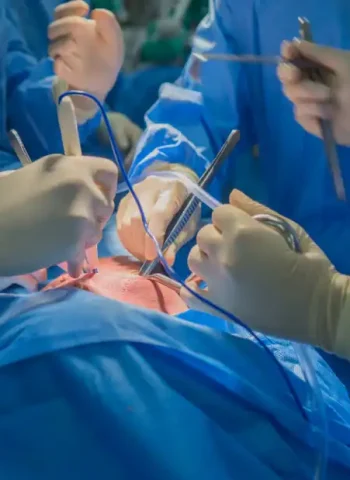 Transplant Surgery 2 Transplant Surgery 2